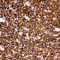 Anti-CD20 Picoband Antibody